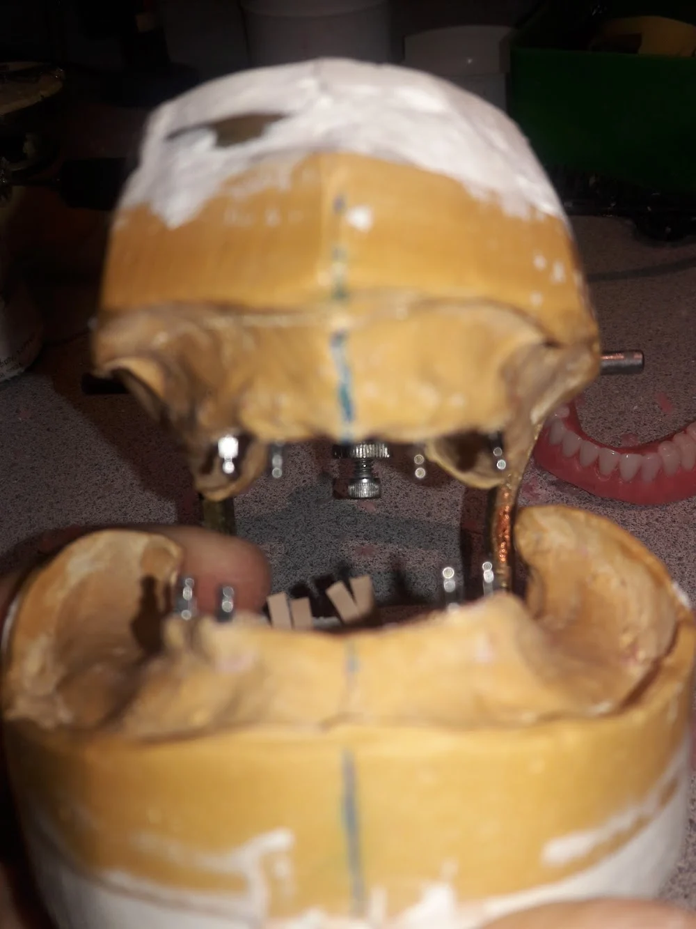 Affordable Dentures & Implants Picture 5
