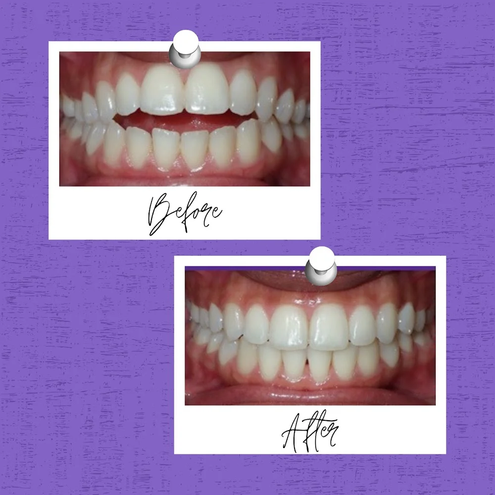 Farrow Orthodontics - Mt. Airy Picture 3