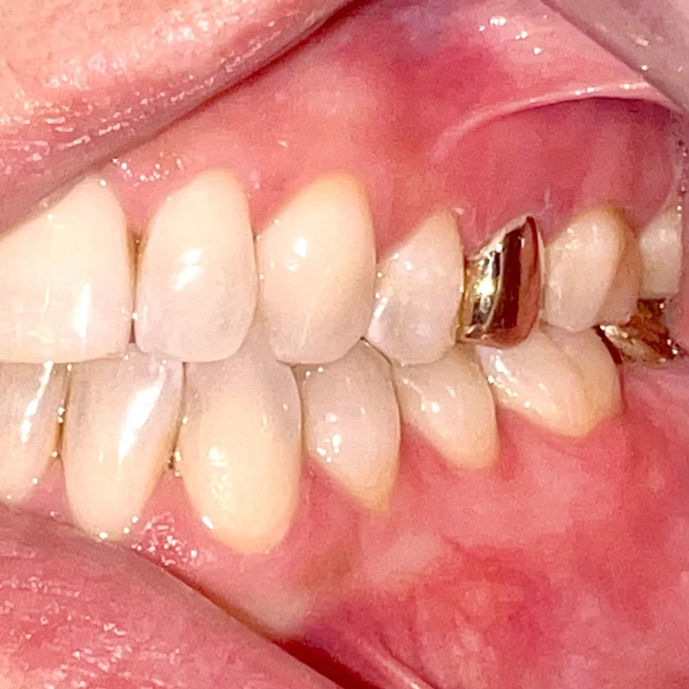 Dental365 - Throgs Neck Picture 4