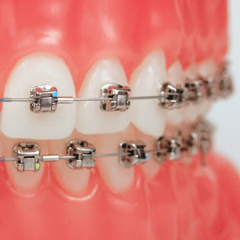 Associated Orthodontists - Joliet Picture 7