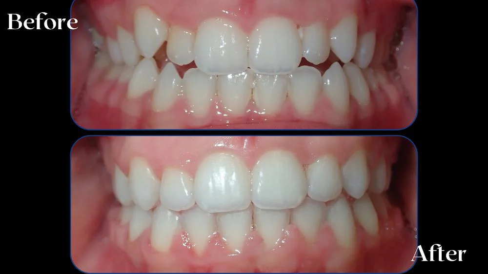 All Smiles Orthodontics Picture 5