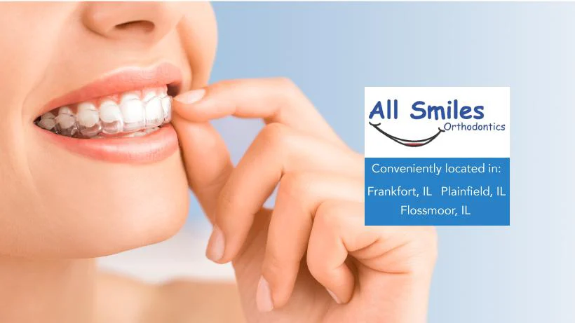 All Smiles Orthodontics Picture 3