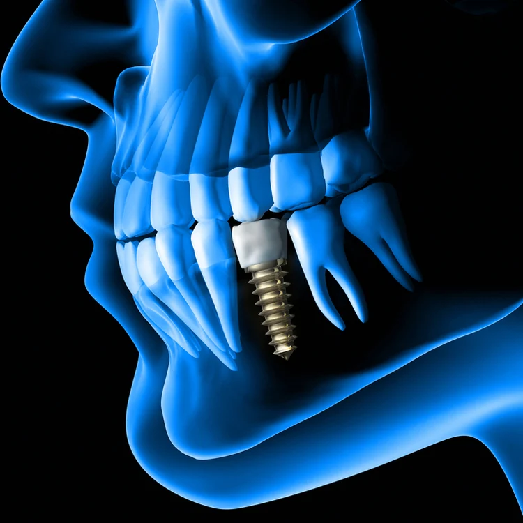 Dr. Vu Kong, DDS Picture 8