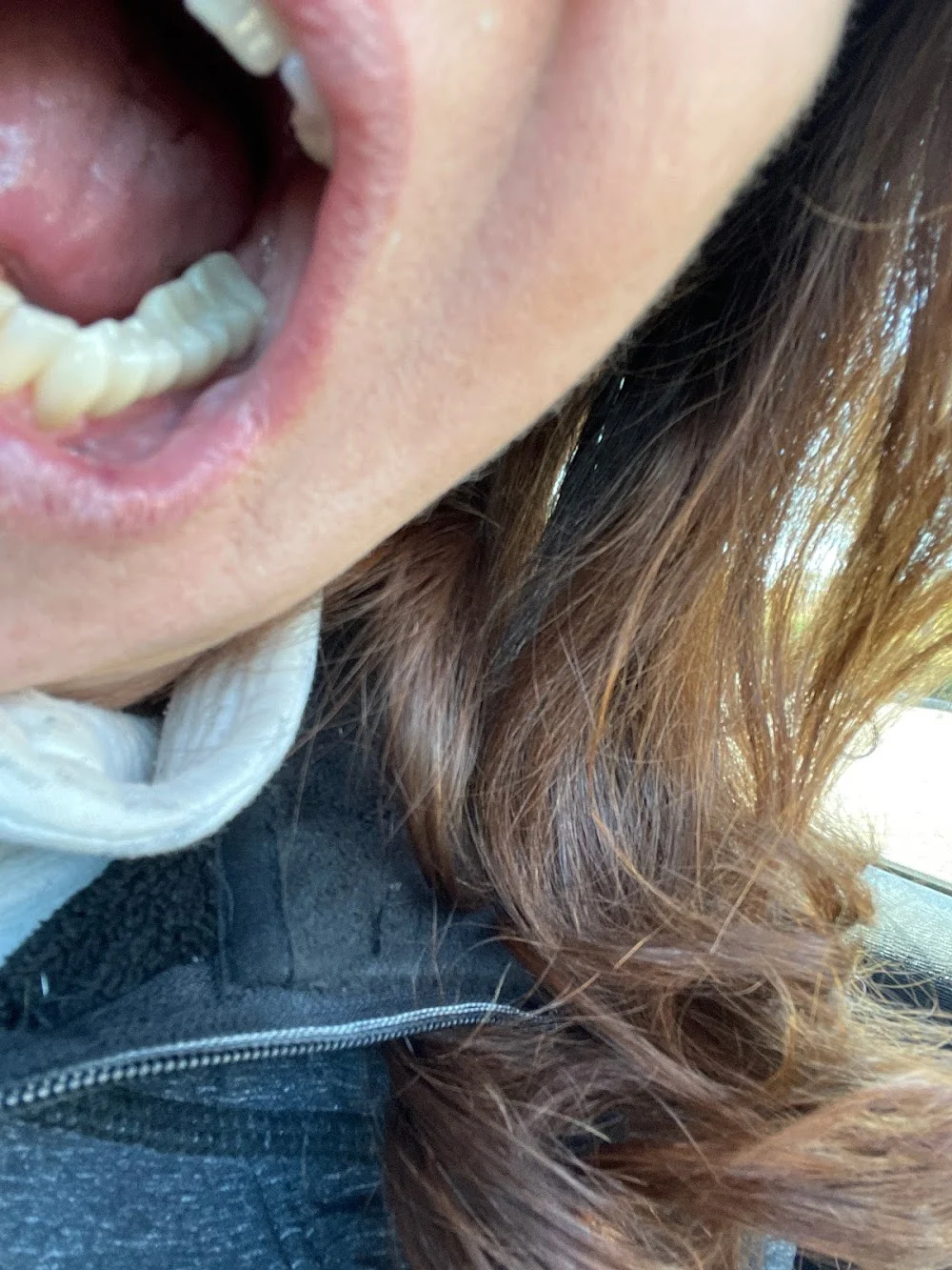 Long Grove Dental Picture 4
