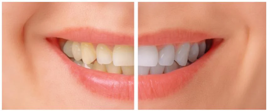 Mundelein Dental Center Picture 5