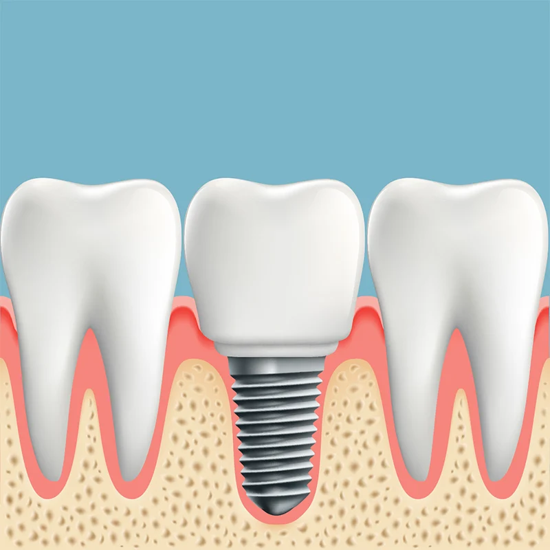 Diamond Dental Service Picture 4