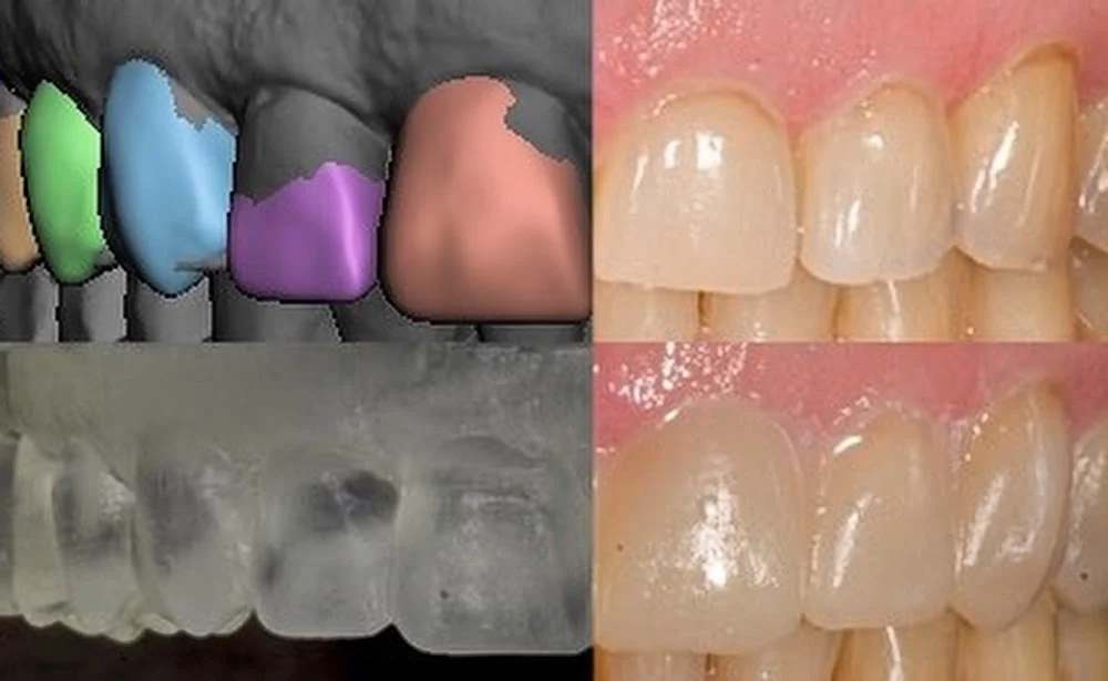 Barrington Dental - Drs. Russell P. Fitton III and IV, DDS Picture 10
