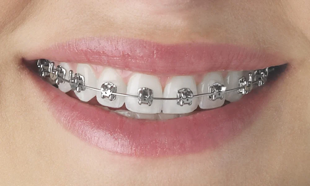 Verbic Orthodontics Picture 7