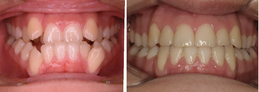 Arpino Orthodontics Picture 10