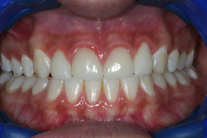 Aurora Dental Group Picture 9