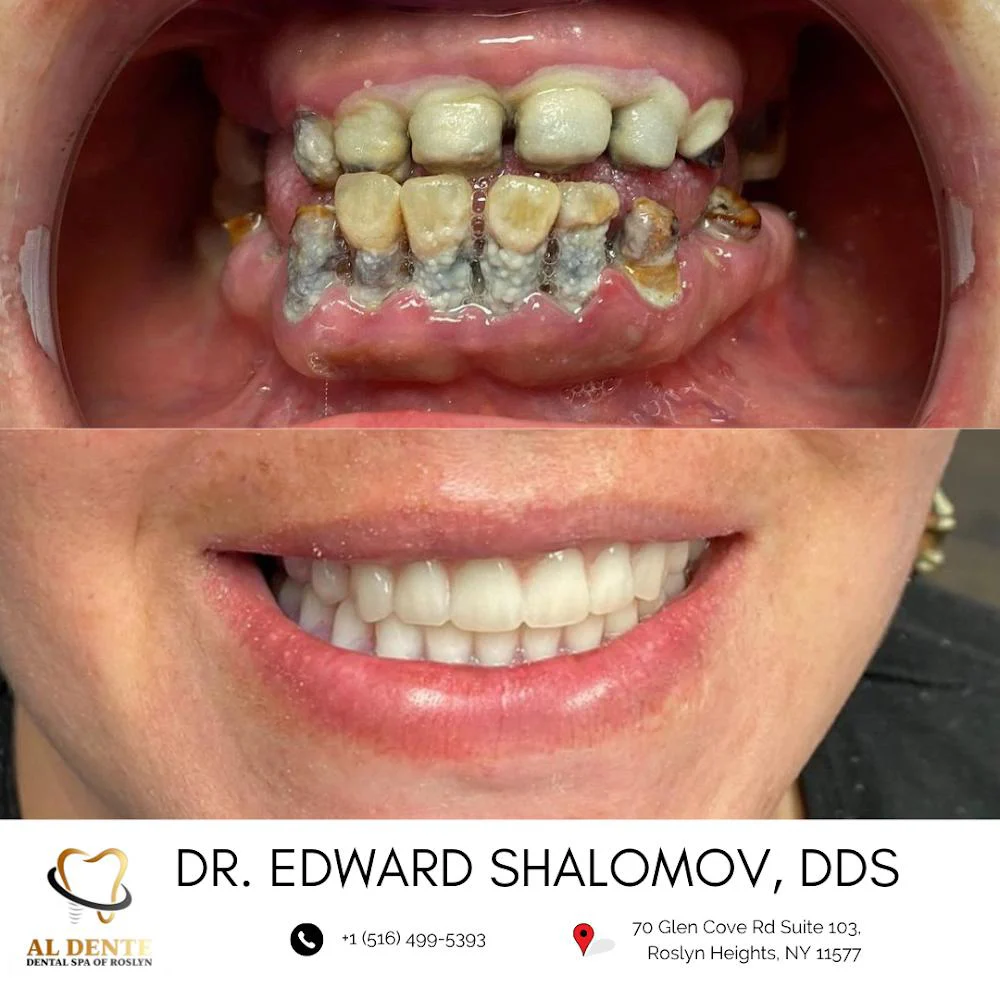 AL Dente Dental Spa of Roslyn - Dr. Edward Shalomov & Dr. Daniel Abramov Picture 5