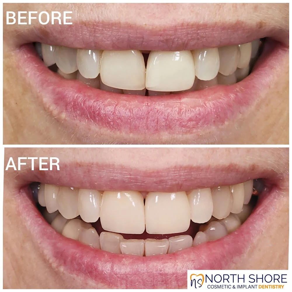 North Shore Cosmetic and Implant Dentistry Picture 9