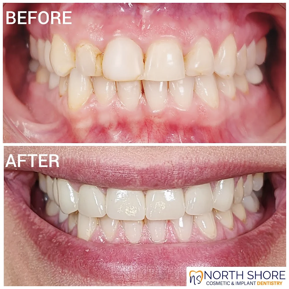 North Shore Cosmetic and Implant Dentistry Picture 6