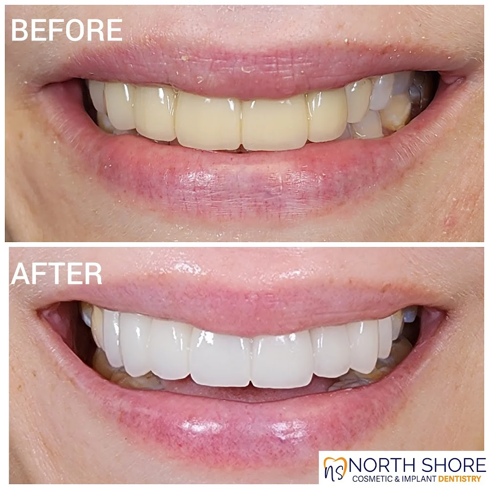 North Shore Cosmetic and Implant Dentistry Picture 10