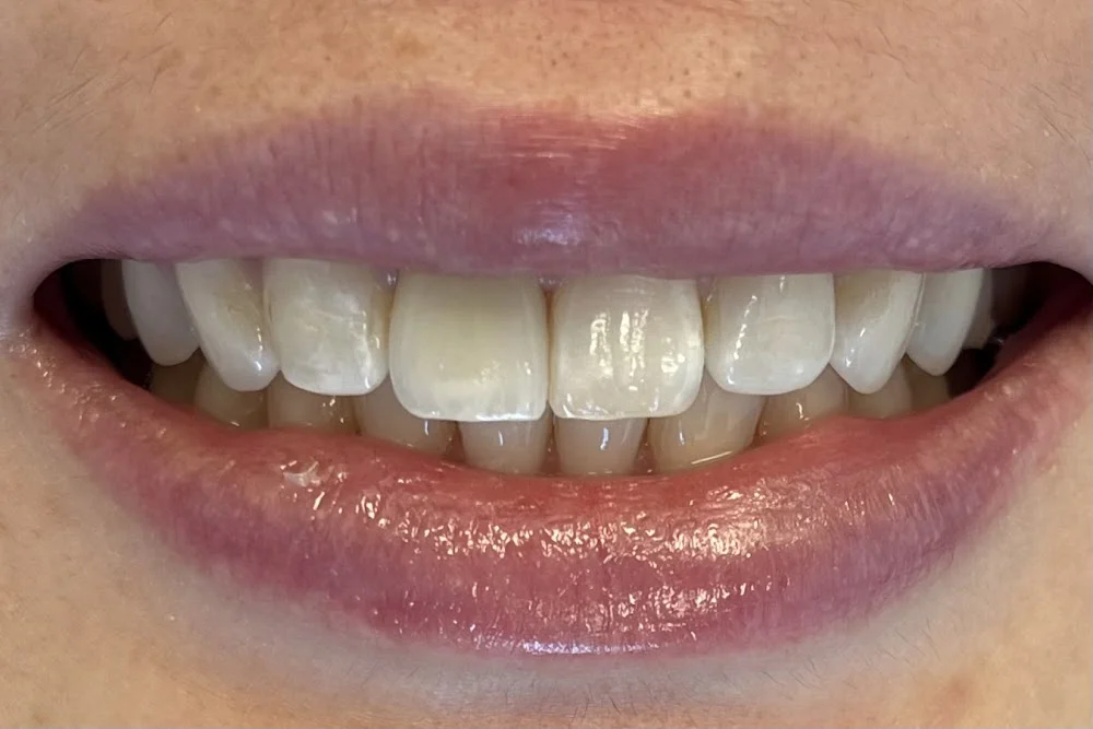 Smilosophy Dental Picture 5