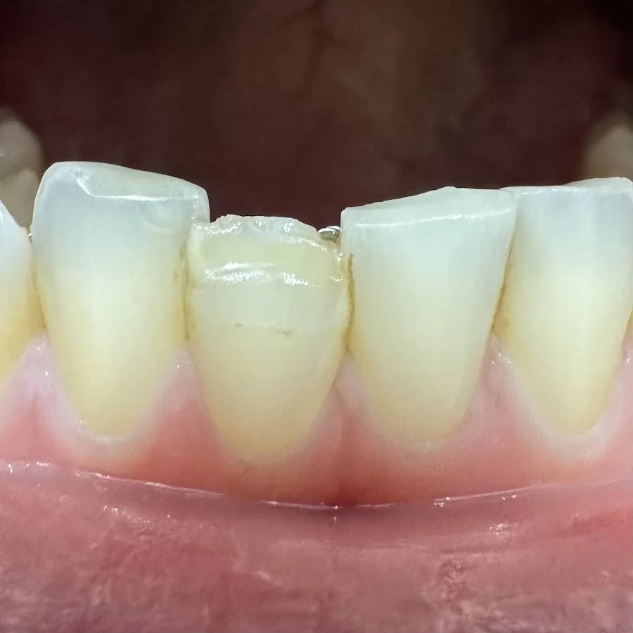Gentle Dental Tempe Picture 3