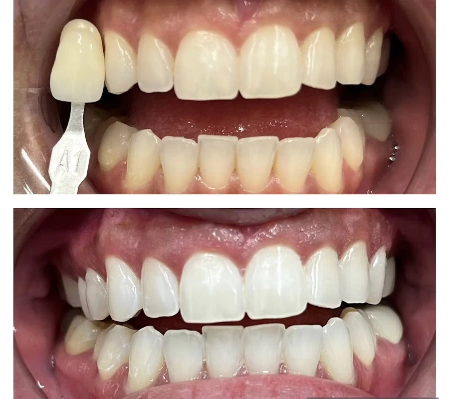 Image Plus Dental Picture 1