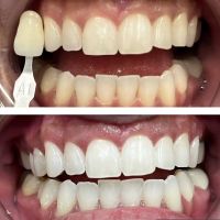 Image Plus Dental ico