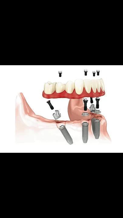 My OC Dental Care Picture 5