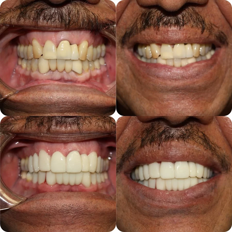 My OC Dental Care Picture 10
