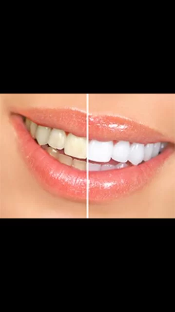 My OC Dental Care Picture 4