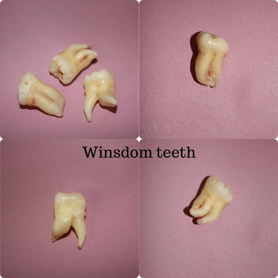 My OC Dental Care Picture 9