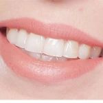 Capstone Dental Care