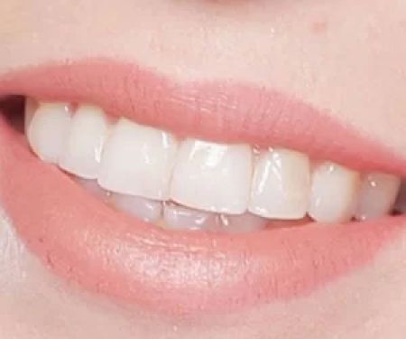 Capstone Dental Care
