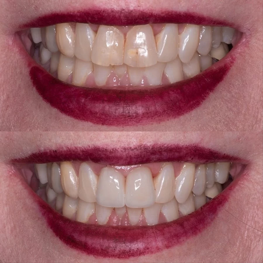 Mission Dental - Yorba Linda Picture 7
