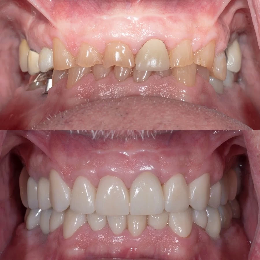 Mission Dental - Yorba Linda Picture 4