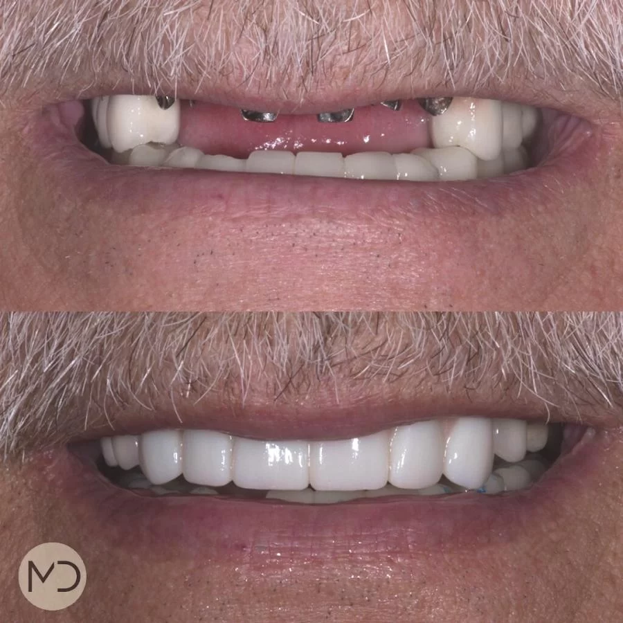 Mission Dental - Yorba Linda Picture 9