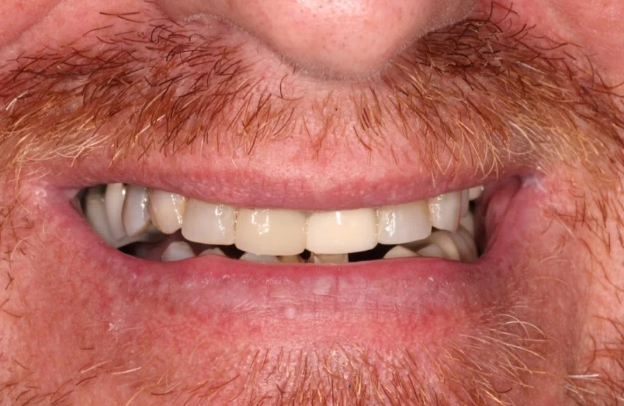 Tempe Smile Design Picture 6