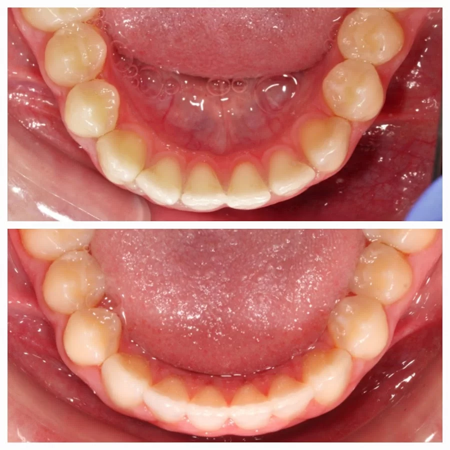Tempe Smile Design Picture 8