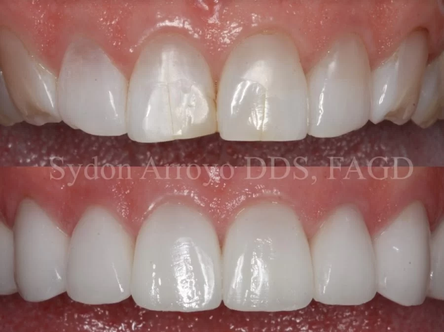 Skypark Dental Professionals - Sydon Arroyo, DDS, APC Picture 2
