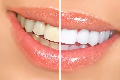 Anaheim Hills Village Dentistry Picture 4