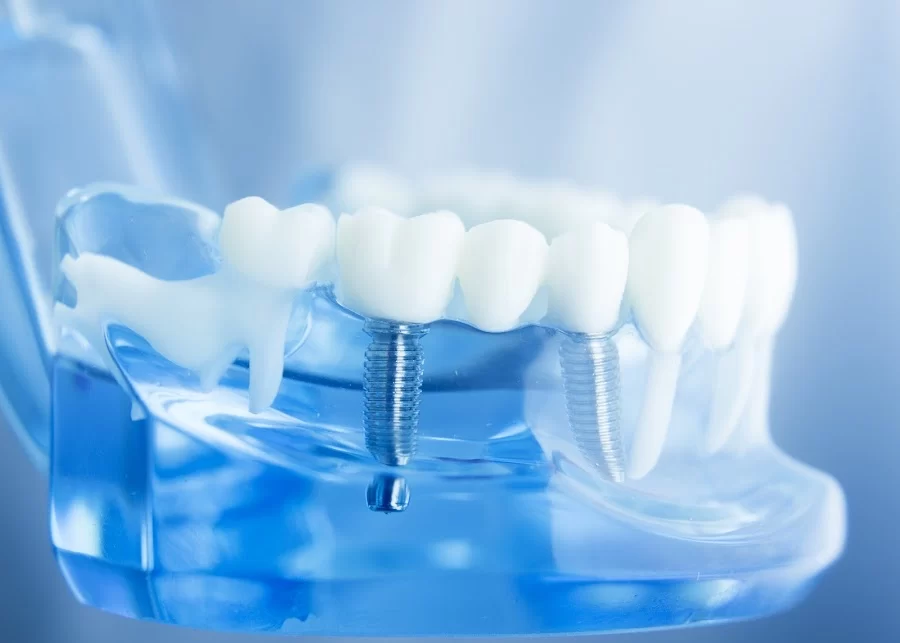 Anaheim Hills Village Dentistry Picture 7