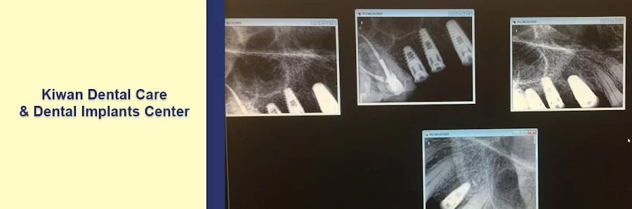 Kiwan Dental Care & Dental Implants Center Picture 3