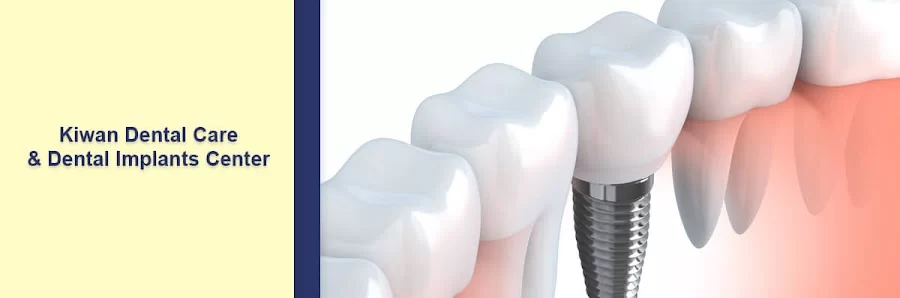 Kiwan Dental Care & Dental Implants Center Picture 2
