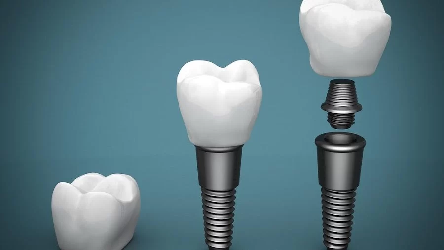 Kiwan Dental Care & Dental Implants Center Picture 6