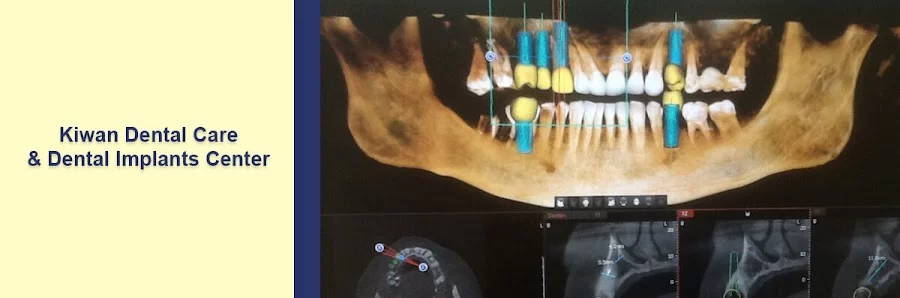 Kiwan Dental Care & Dental Implants Center Picture 5