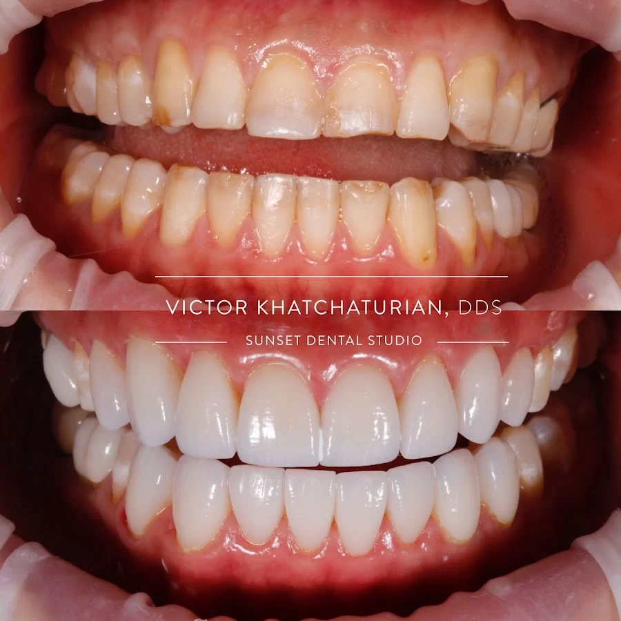 Sunset Dental Studio Picture 5