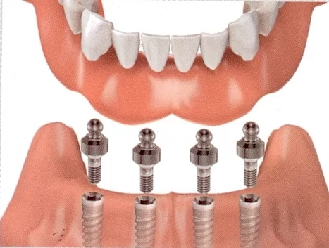Smile Again Dental Center Picture 2