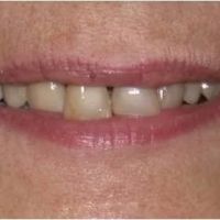 Nainesh A Desai, DDS ico