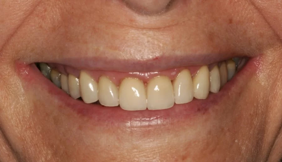 Nainesh A Desai, DDS Picture 6