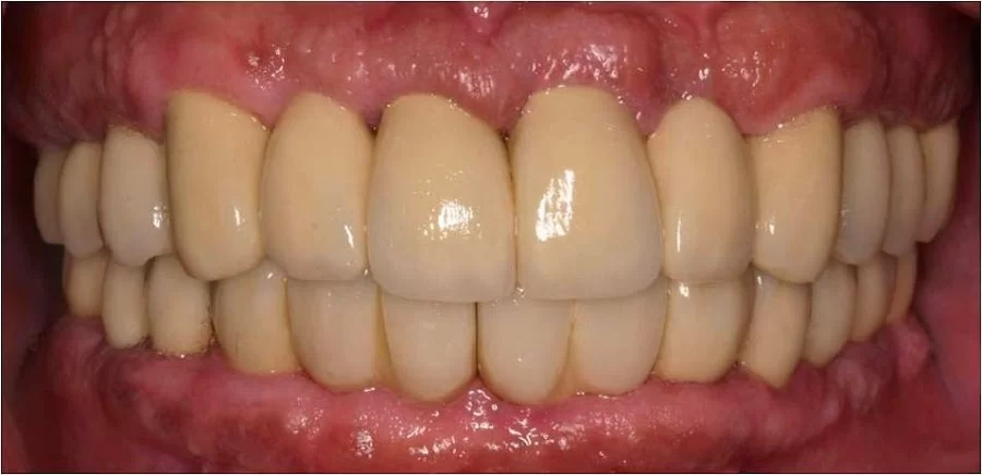 Nainesh A Desai, DDS Picture 4