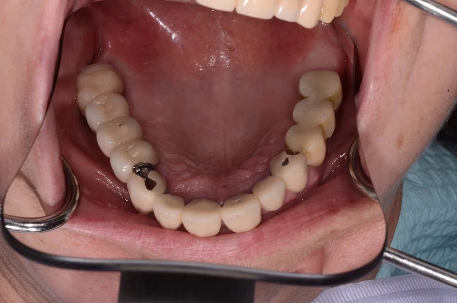 Nainesh A Desai, DDS Picture 7