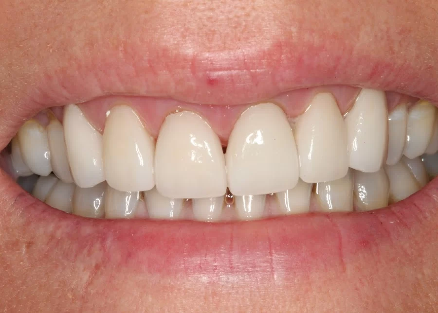 Tempe Family Dentistry Picture 1