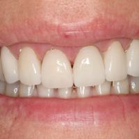 Tempe Family Dentistry ico