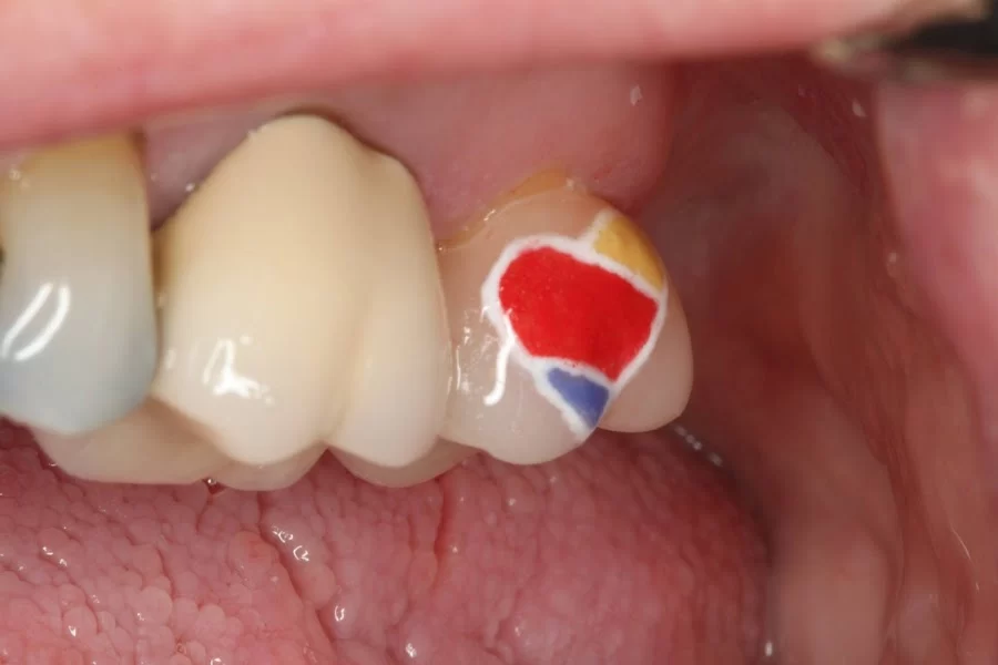 Drew Family Dentistry Picture 3