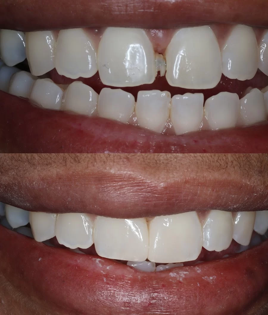 Phillips Ranch Dental Group Picture 7